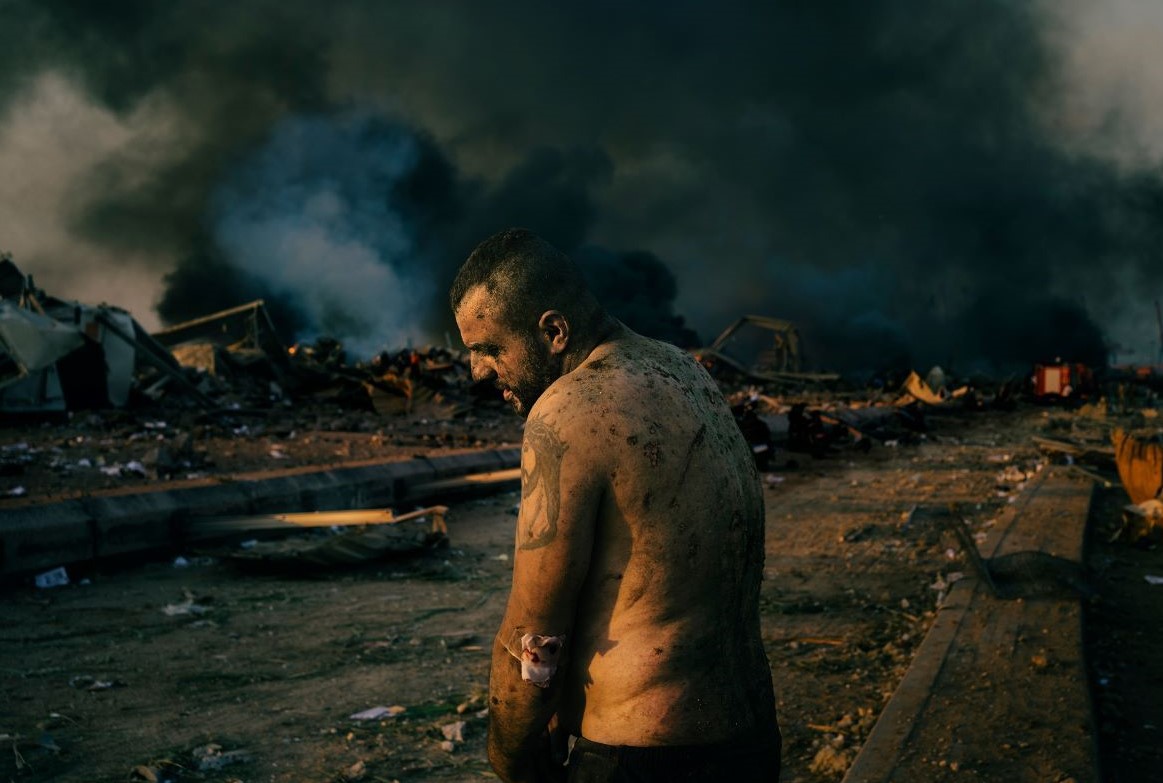 Izložba najboljih svjetskih novinskih fotografija po 20. put u Beču