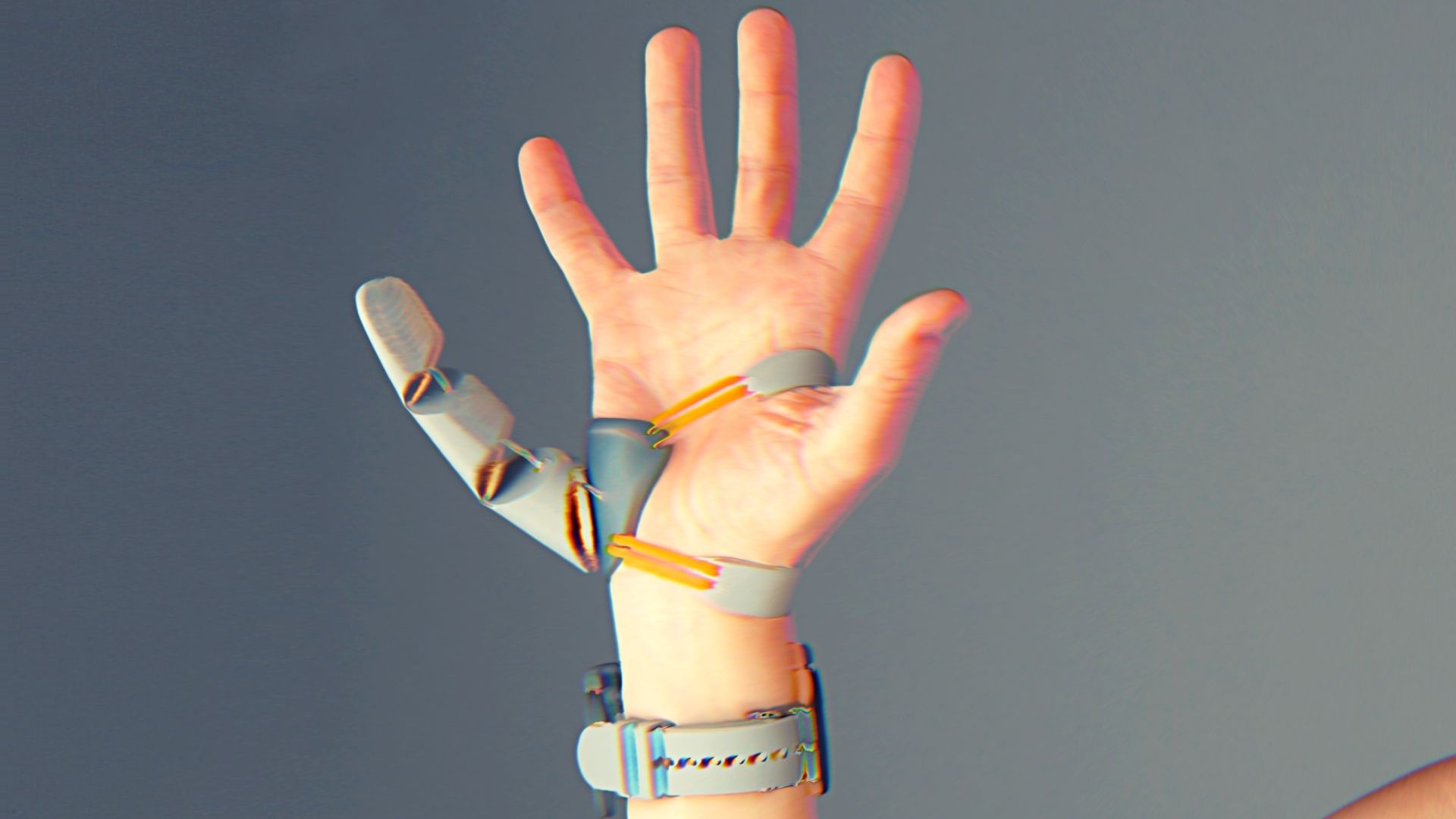 3D isprintani robotski palac je nova dimenzija u protetici