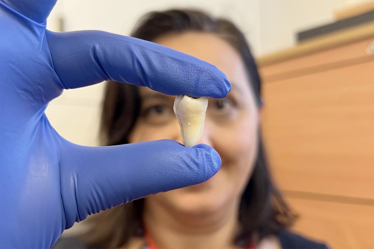 Laboratorijski uzgojeni zubi mogli bi ponuditi prirodnu alternativu zubnim ispunama